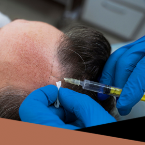 MESOTERAPIA